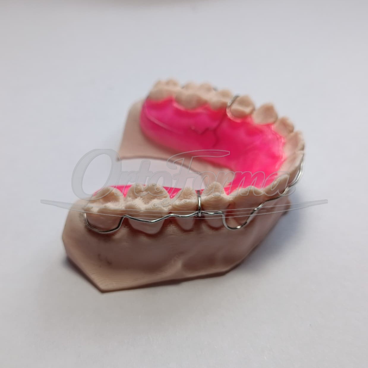Trabalho de laboratório ortodôntico da OrtoForma — publicação do Instagram